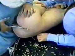 Cutting of the ass