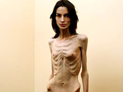 Anorexic slave for pain
