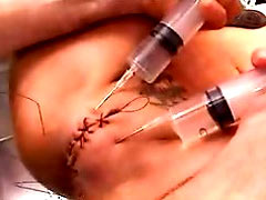 Sewing and injections