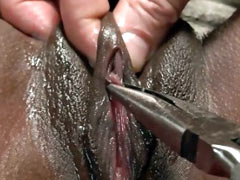 Pain for clitoris